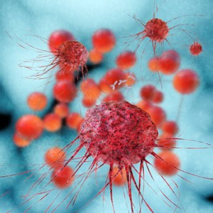 Diagnostik von Krebs-Zellen in der Onkologie